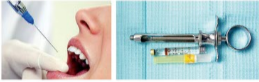 胰島素，牙科麻醉6.png